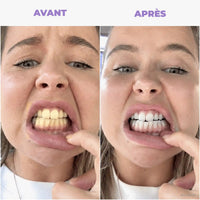S04 Avant Après