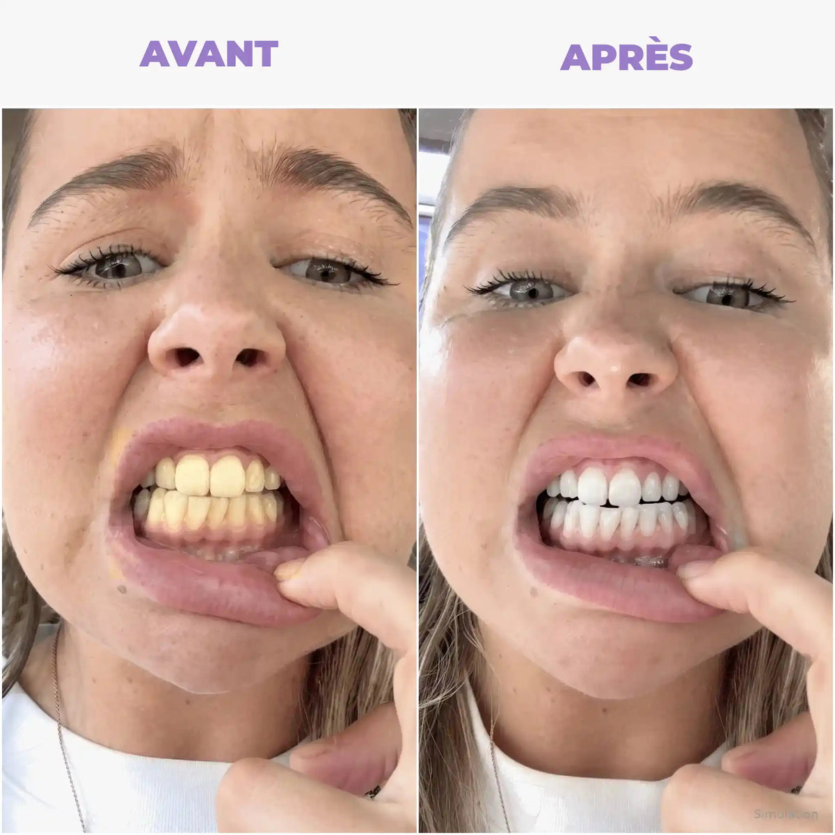 S04 Avant Après