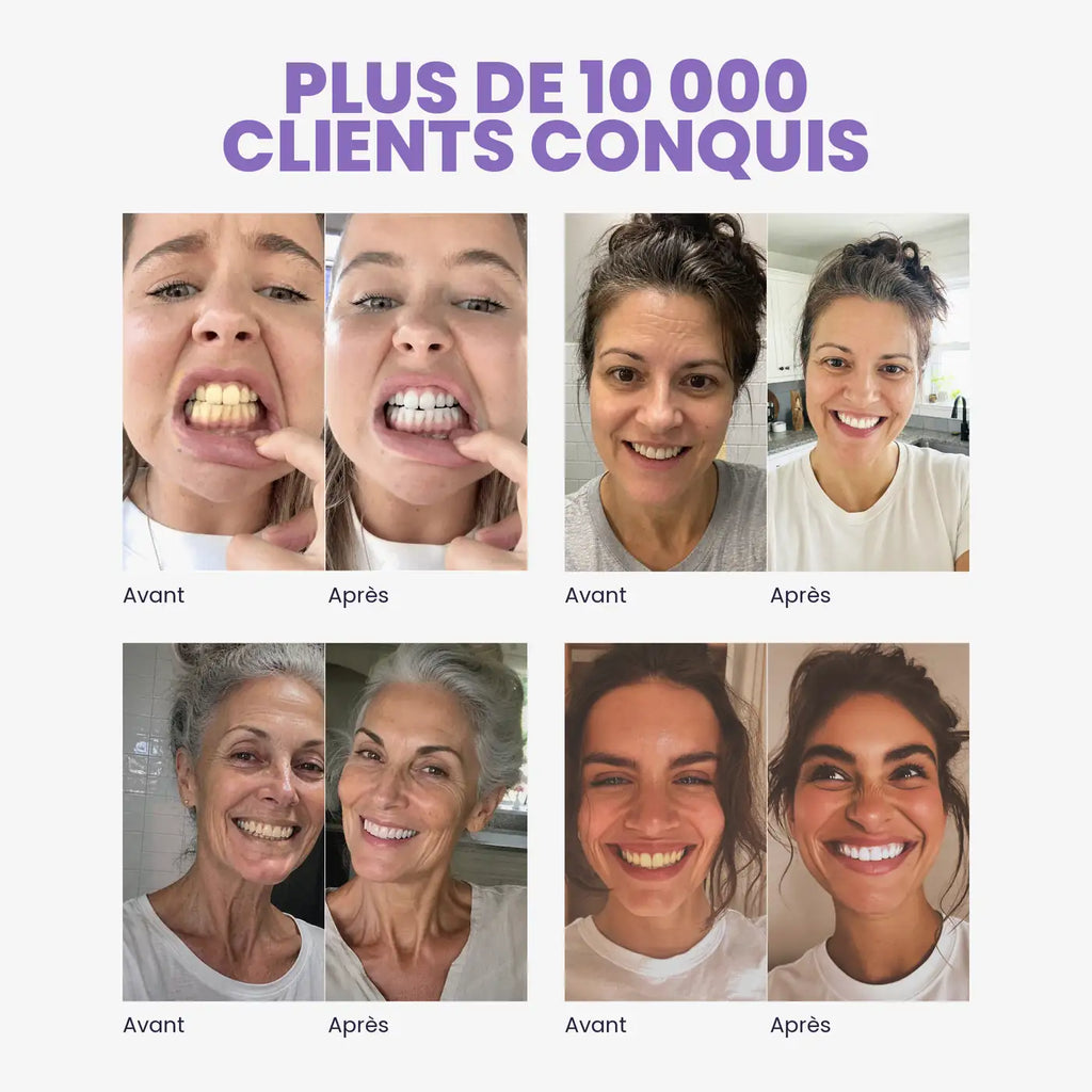 Quatre avant/après de clientes MR.SMILE — plus de 10 000 clients conquis