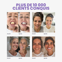 Quatre avant/après de clientes MR.SMILE — plus de 10 000 clients conquis